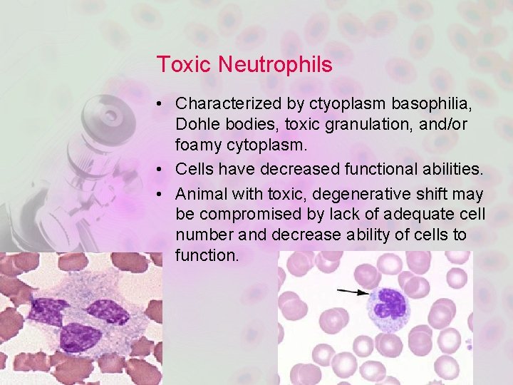 Toxic Neutrophils • Characterized by ctyoplasm basophilia, Dohle bodies, toxic granulation, and/or foamy cytoplasm.
