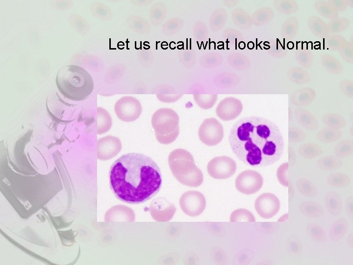 Let us recall what looks Normal. 