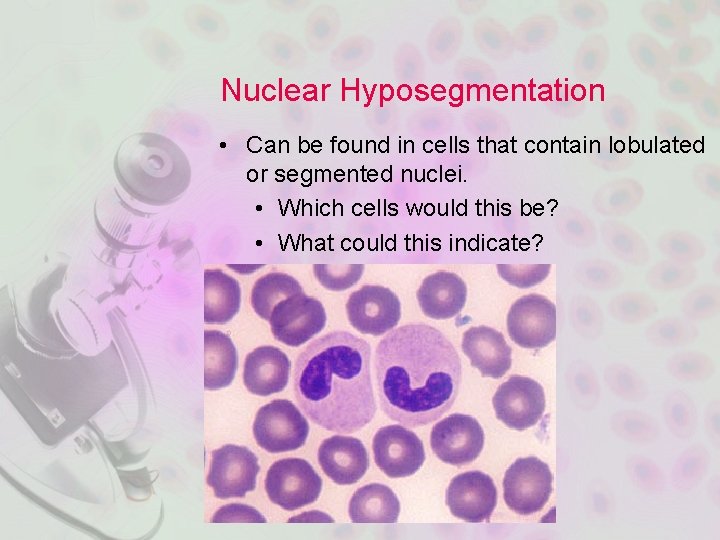 Nuclear Hyposegmentation • Can be found in cells that contain lobulated or segmented nuclei.