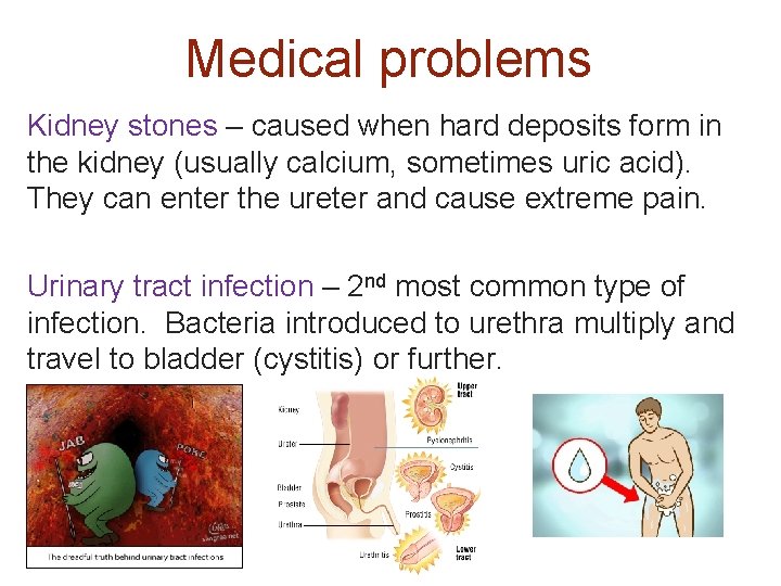 Medical problems Kidney stones – caused when hard deposits form in the kidney (usually