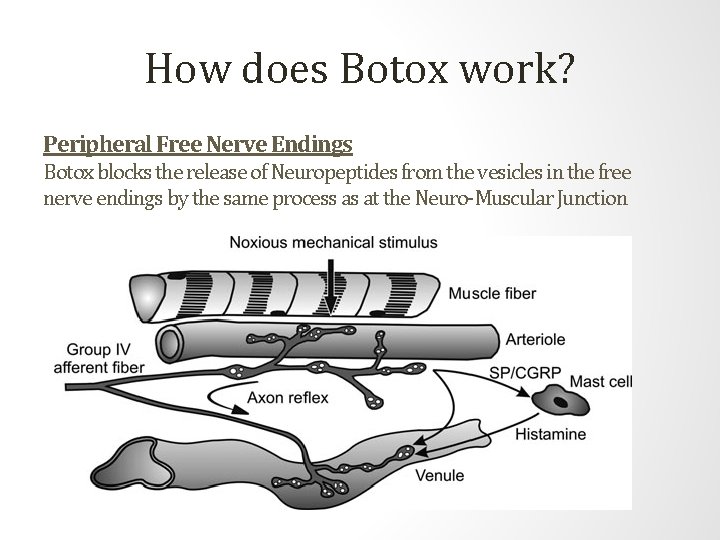 How does Botox work? Peripheral Free Nerve Endings Botox blocks the release of Neuropeptides