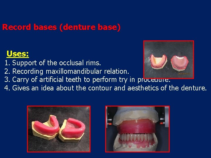 Record bases (denture base) Uses: 1. 2. 3. 4. Support of the occlusal rims.