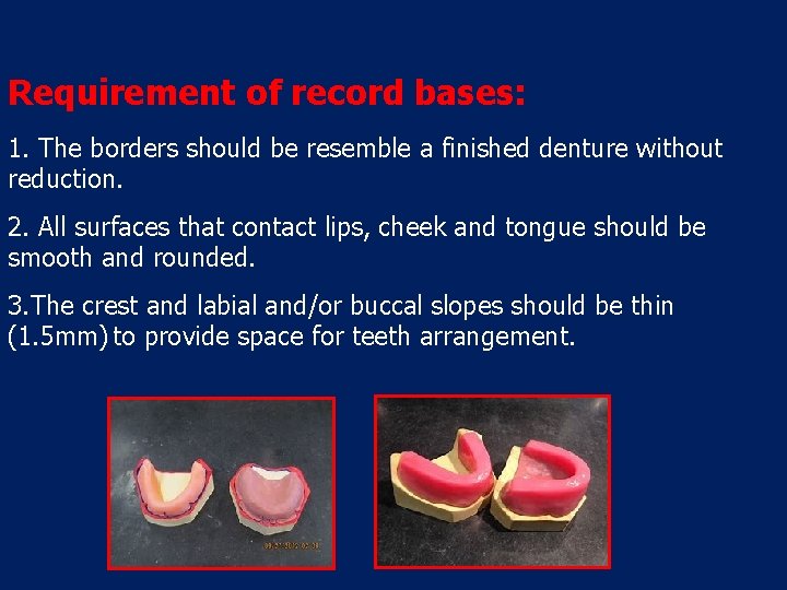 Requirement of record bases: 1. The borders should be resemble a finished denture without
