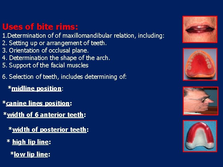 Uses of bite rims: 1. Determination of of maxillomandibular relation, including: 2. Setting up