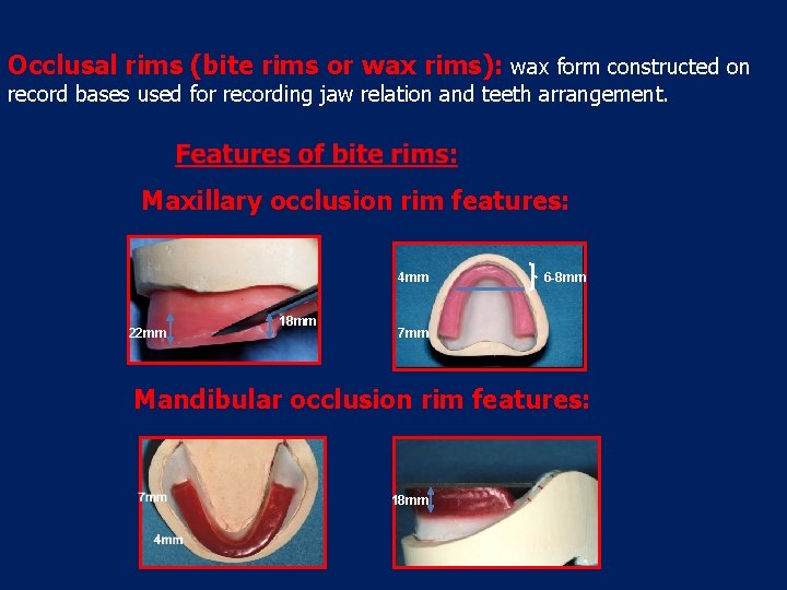 RECORD BASE AND OCCLUSAL RIM Dr Ali Ehsan
