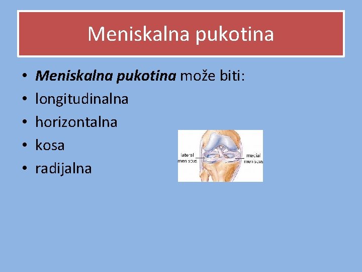 Meniskalna pukotina • • • Meniskalna pukotina može biti: longitudinalna horizontalna kosa radijalna Meniskalna pukotina • • • Meniskalna pukotina može biti: longitudinalna horizontalna kosa radijalna