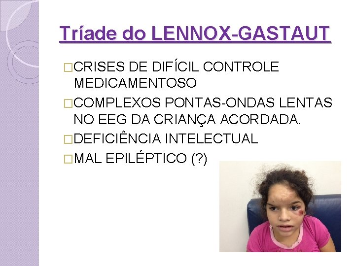 Tríade do LENNOX-GASTAUT �CRISES DE DIFÍCIL CONTROLE MEDICAMENTOSO �COMPLEXOS PONTAS-ONDAS LENTAS NO EEG DA