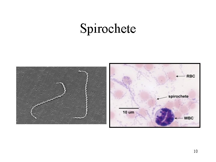 Spirochete 10 