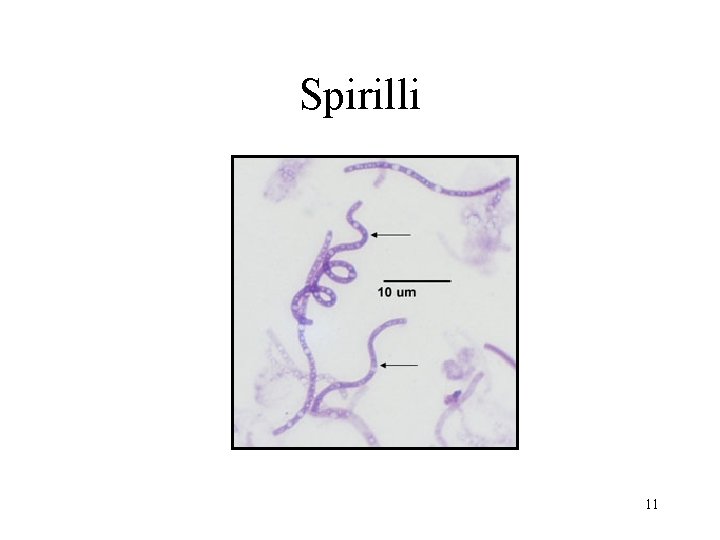 Spirilli 11 