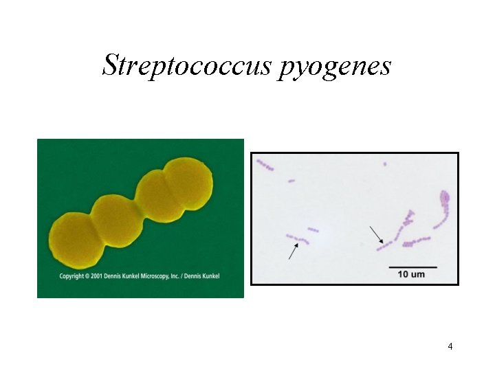 Streptococcus pyogenes 4 