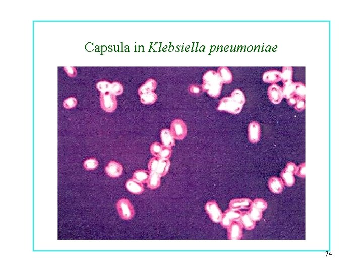 Capsula in Klebsiella pneumoniae 74 