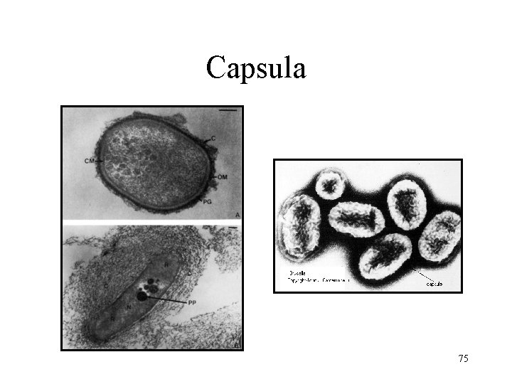 Capsula 75 