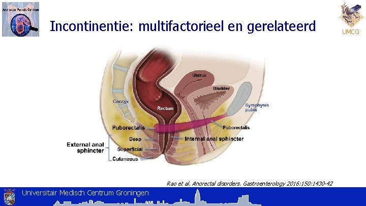 Incontinentie: multifactorieel en gerelateerd Rao et al. Anorectal disorders. Gastroenterology 2016: 150: 1430 -42