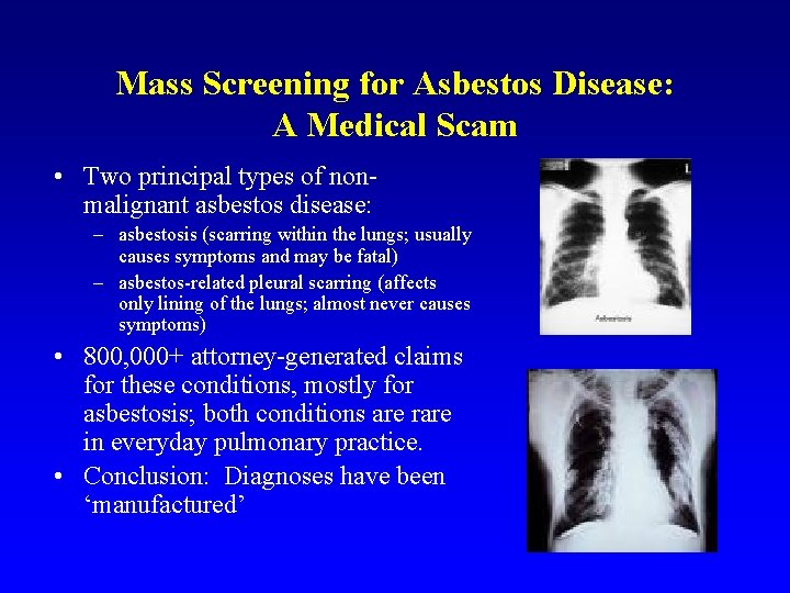 Mass Screening for Asbestos Disease: A Medical Scam • Two principal types of nonmalignant