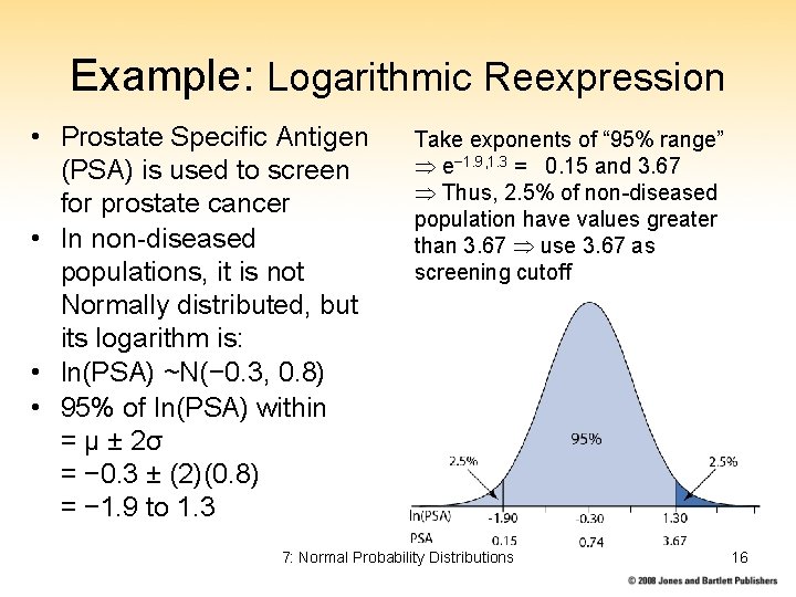 Example: Logarithmic Reexpression • Prostate Specific Antigen (PSA) is used to screen for prostate