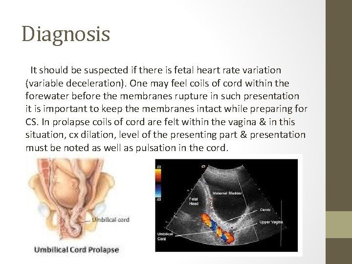 Diagnosis It should be suspected if there is fetal heart rate variation (variable deceleration).