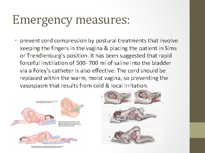 Emergency measures: • prevent cord compression by postural treatments that involve keeping the fingers