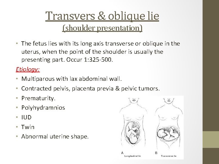 Transvers & oblique lie (shoulder presentation) • The fetus lies with its long axis