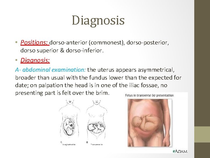 Diagnosis • Positions: dorso-anterior (commonest), dorso-posterior, dorso superior & dorso-inferior. • Diagnosis: A- abdominal