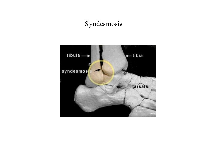 Syndesmosis 