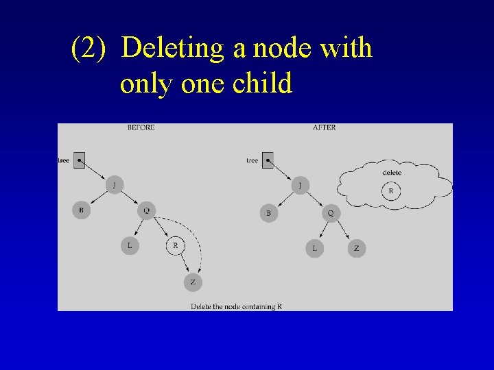(2) Deleting a node with only one child (2) Deleting a node with only one child