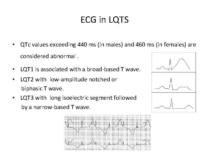 ECG in LQTS • QTc values exceeding 440 ms (in males) and 460 ms