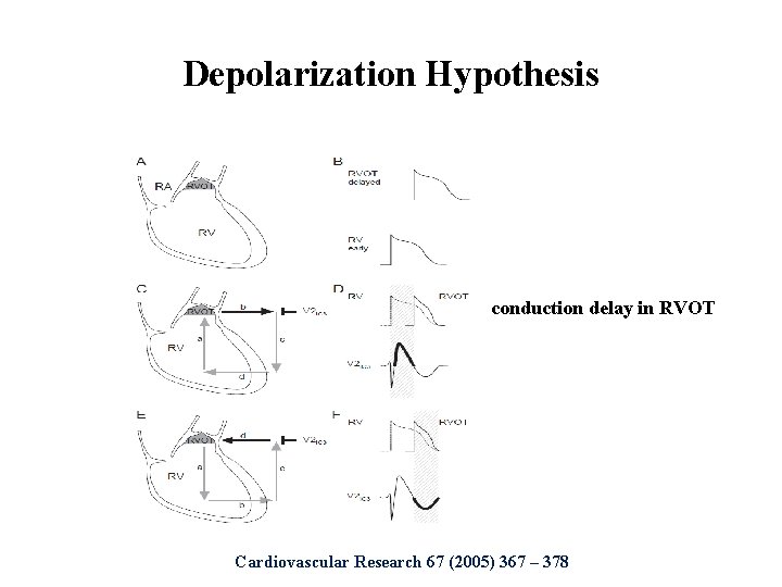 Depolarization Hypothesis conduction delay in RVOT Cardiovascular Research 67 (2005) 367 – 378 