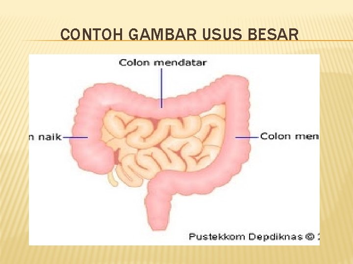 CONTOH GAMBAR USUS BESAR 