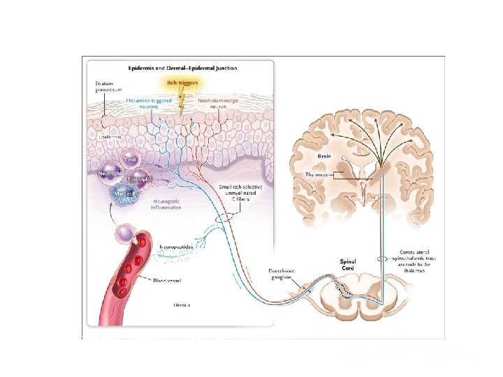 Pathways of Itch from Skin to Brain. Yosipovitch G, Bernhard JD. N Engl J