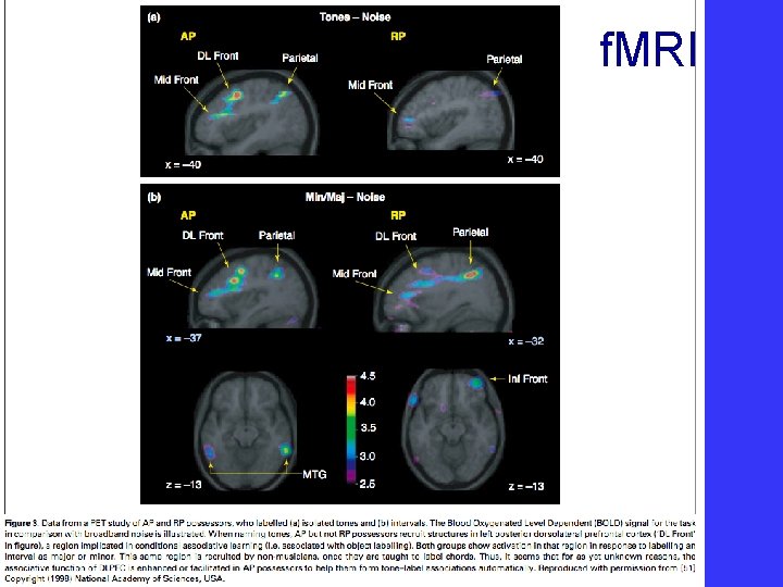 f. MRI 