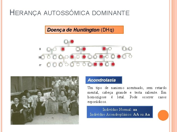 HERANÇA AUTOSSÔMICA DOMINANTE Doença de Huntington (DHq) Acondrolasia Um tipo de nanismo acentuado, sem