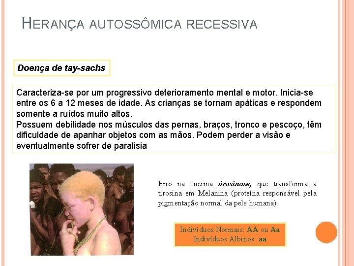 HERANÇA AUTOSSÔMICA RECESSIVA Doença de tay-sachs Caracteriza-se por um progressivo deterioramento mental e motor.