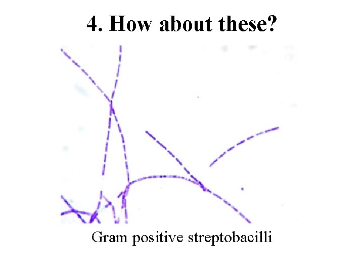 4. How about these? Gram positive streptobacilli 