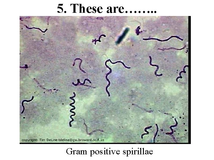 5. These are……. . Gram positive spirillae 