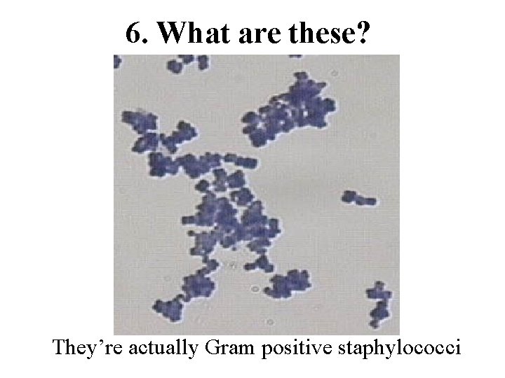 6. What are these? They’re actually Gram positive staphylococci 