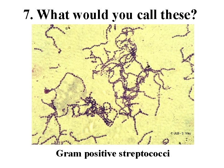 7. What would you call these? Gram positive streptococci 