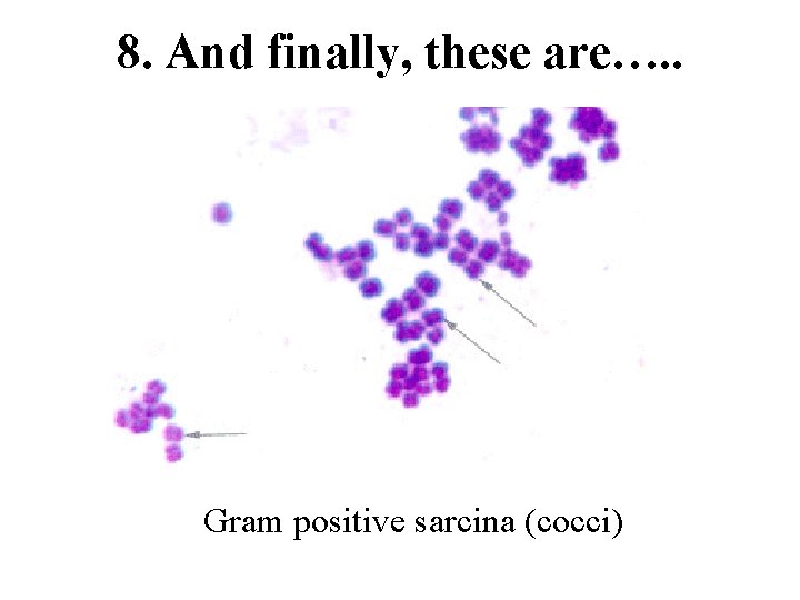 8. And finally, these are…. . Gram positive sarcina (cocci) 