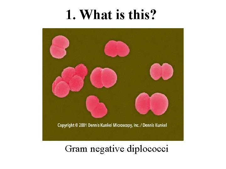 1. What is this? Gram negative diplococci 