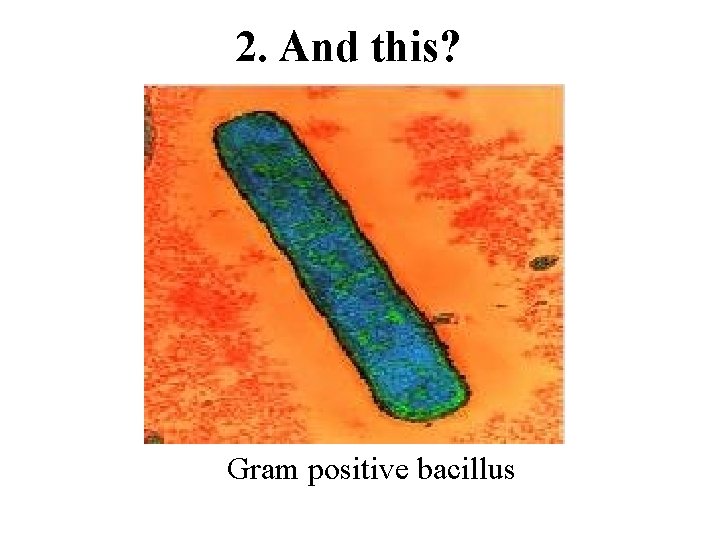2. And this? Gram positive bacillus 