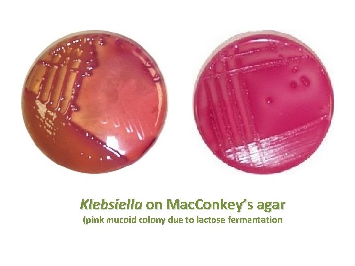 Klebsiella on Mac. Conkey’s agar (pink mucoid colony due to lactose fermentation 