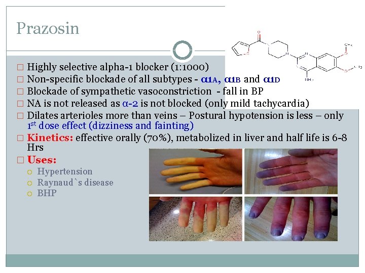 Prazosin � Highly selective alpha-1 blocker (1: 1000) � Non-specific blockade of all subtypes