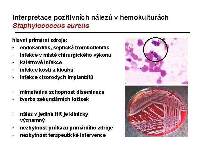 Interpretace pozitivních nálezů v hemokulturách Staphylococcus aureus hlavní primární zdroje: • endokarditis, septická tromboflebitis