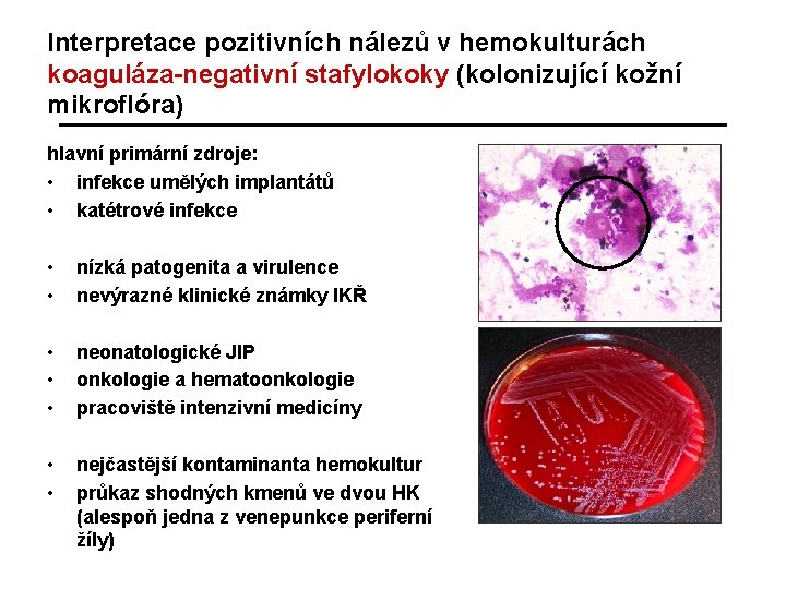 Interpretace pozitivních nálezů v hemokulturách koaguláza-negativní stafylokoky (kolonizující kožní mikroflóra) hlavní primární zdroje: •