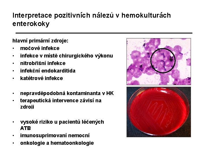 Interpretace pozitivních nálezů v hemokulturách enterokoky hlavní primární zdroje: • močové infekce • infekce