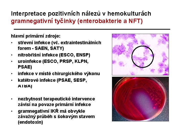 Interpretace pozitivních nálezů v hemokulturách gramnegativní tyčinky (enterobakterie a NFT) hlavní primární zdroje: •