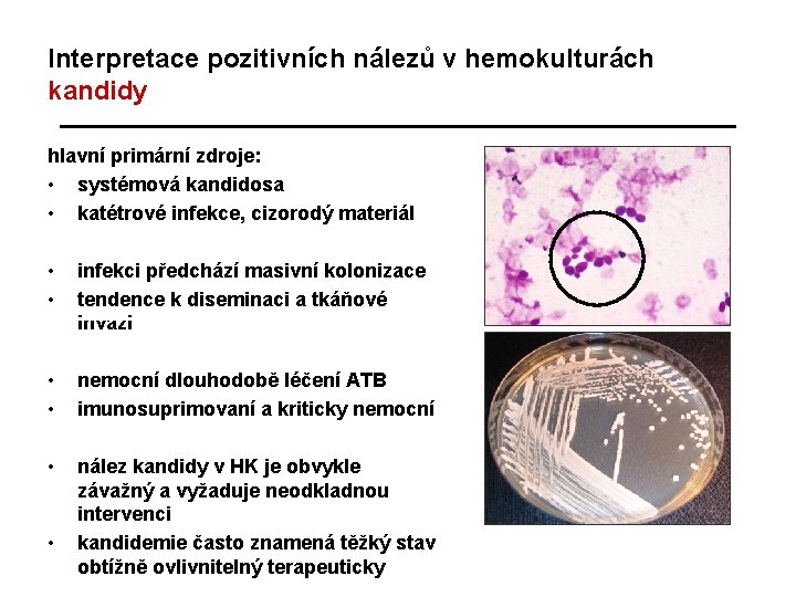 Interpretace pozitivních nálezů v hemokulturách kandidy hlavní primární zdroje: • systémová kandidosa • katétrové