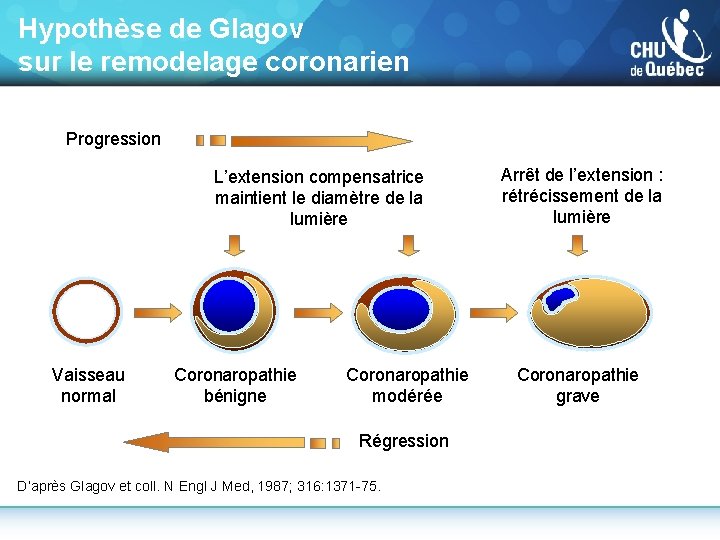Hypothèse de Glagov sur le remodelage coronarien Progression L’extension compensatrice maintient le diamètre de