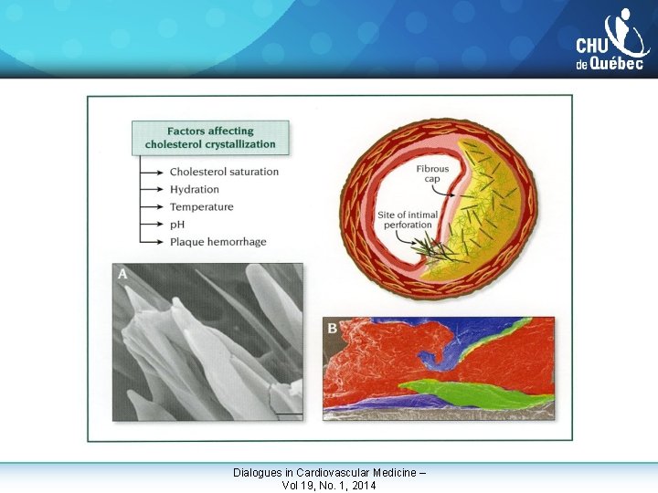 Dialogues in Cardiovascular Medicine – Vol 19, No. 1, 2014 