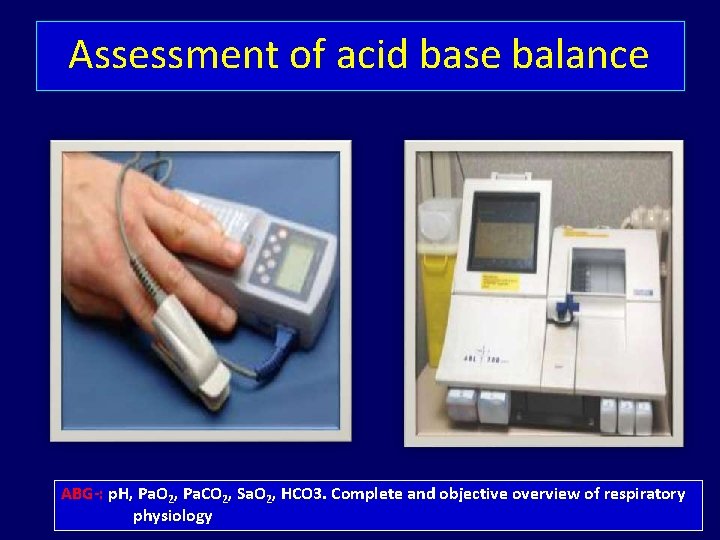 Assessment of acid base balance ABG-: p. H, Pa. O 2, Pa. CO 2,