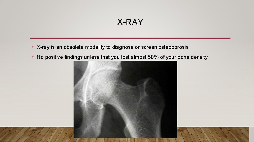 X-RAY • X-ray is an obsolete modality to diagnose or screen osteoporosis • No